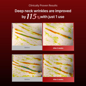MEDITHERAPY Wrinkle-fit Neck Mask ingredients list