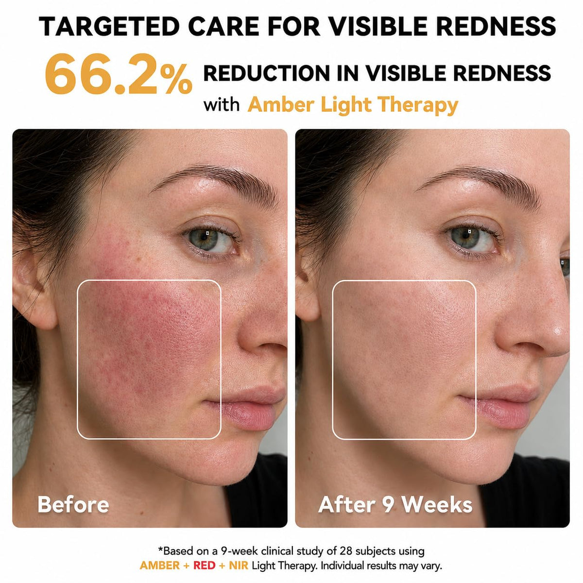 MICEYLIVE LED Face Mask in use on a person relaxing