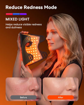 MICEYLIVE LED Face Mask side view showing flexible design