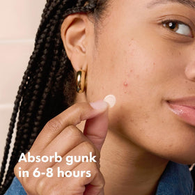 Mighty Patch patches on skin demonstration
