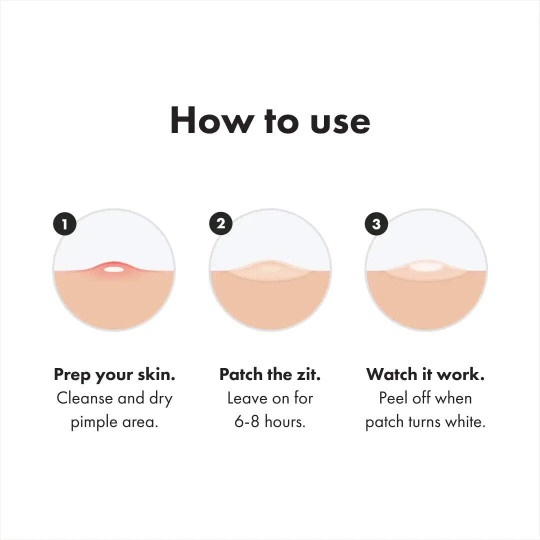 Mighty Patch Surface acne patch in packaging
