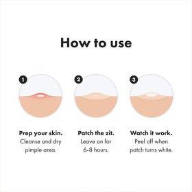 Mighty Patch Surface acne patch in packaging