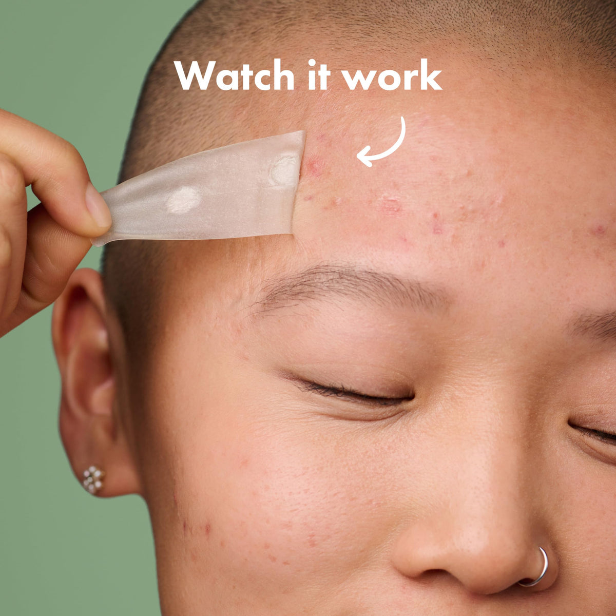Mighty Patch Surface Large Acne Pimple Patches back view with details