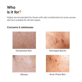Minimalist 10% Panthenol Face Moisturizer texture close-up