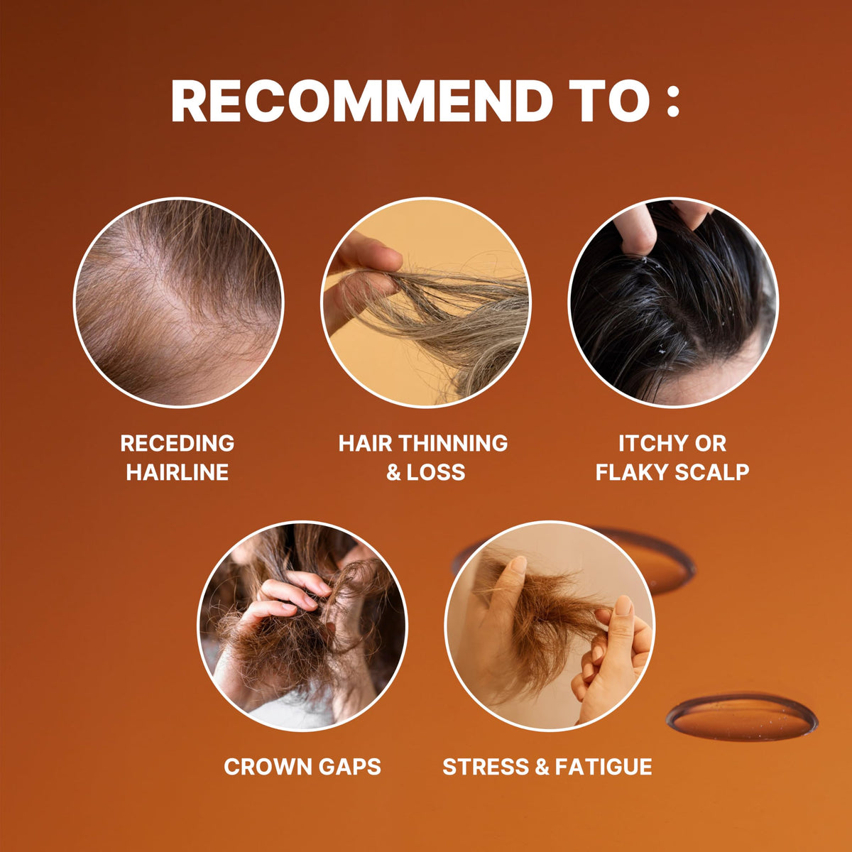 MINOXELL Scalp Intensive Shampoo with ingredients list