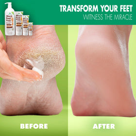 Miracle of Aloe Foot Repair Cream 4 Oz side view