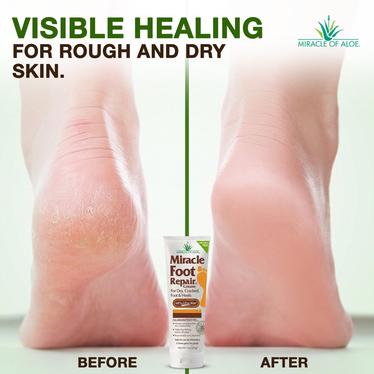 Miracle of Aloe Foot Repair Cream packaging details