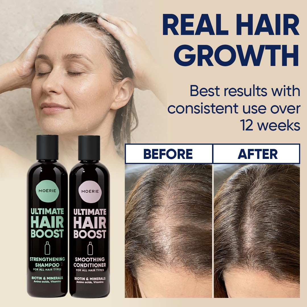 Moerie Hair Growth Conditioner bottle close-up