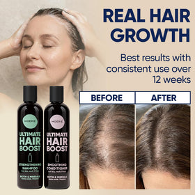 Moerie Hair Growth Conditioner bottle close-up