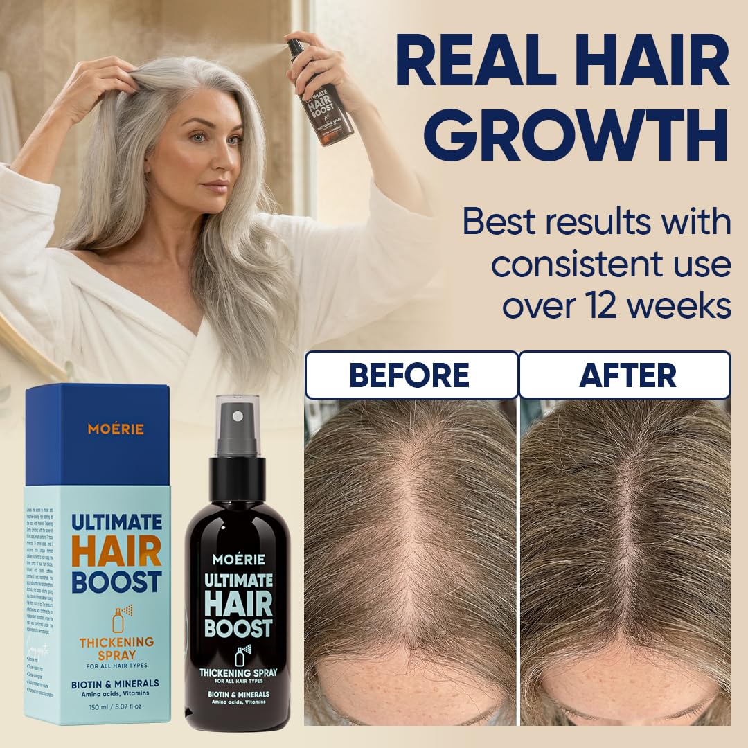 Moerie Hair Growth Serum Spray 150ml side view
