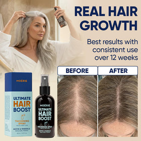 Moerie Hair Growth Serum Spray 150ml side view
