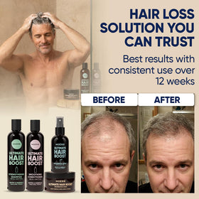 Moerie Hair Growth Spray bottle