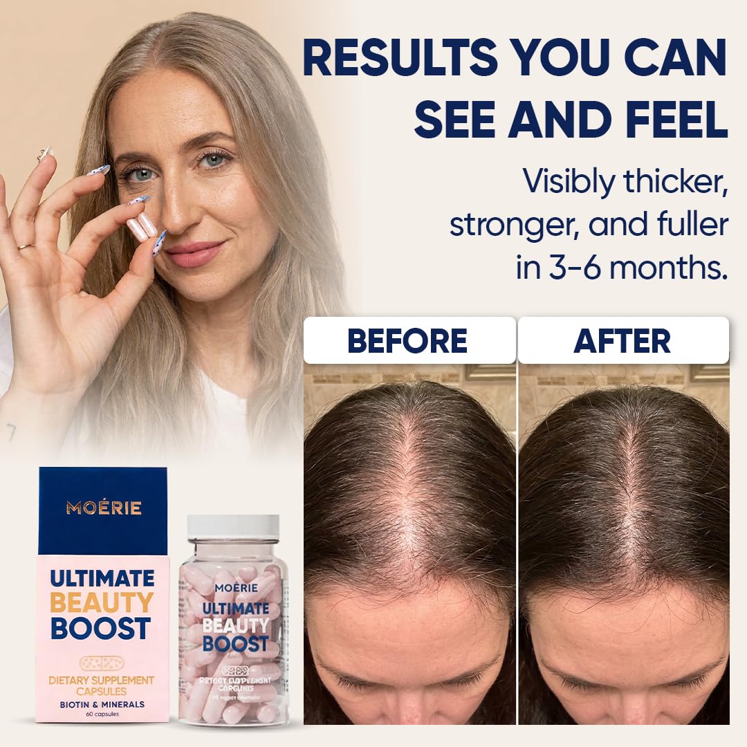 Moerie Hair support Supplements capsules close-up