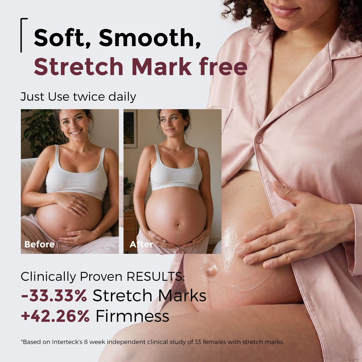 Momcozy Pro-Collagen Stretch Mark Cream application on skin