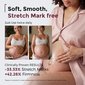 Momcozy Stretch Mark Cream application on belly