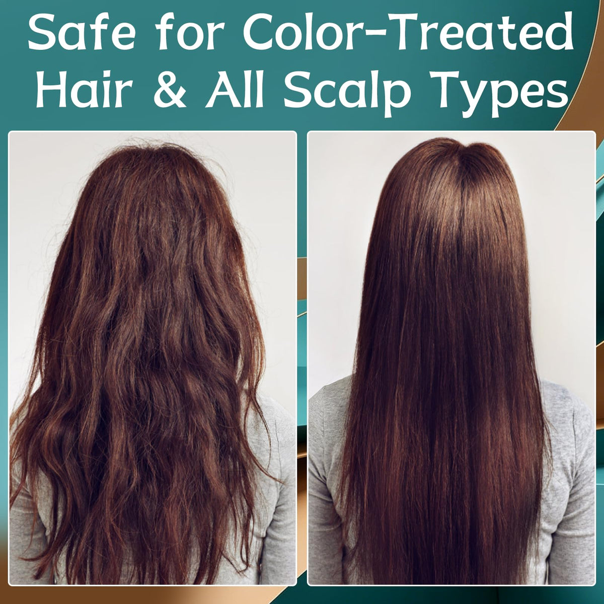 MQN 5% Minoxidil Hair Growth Scalp Massage Cream lifestyle use
