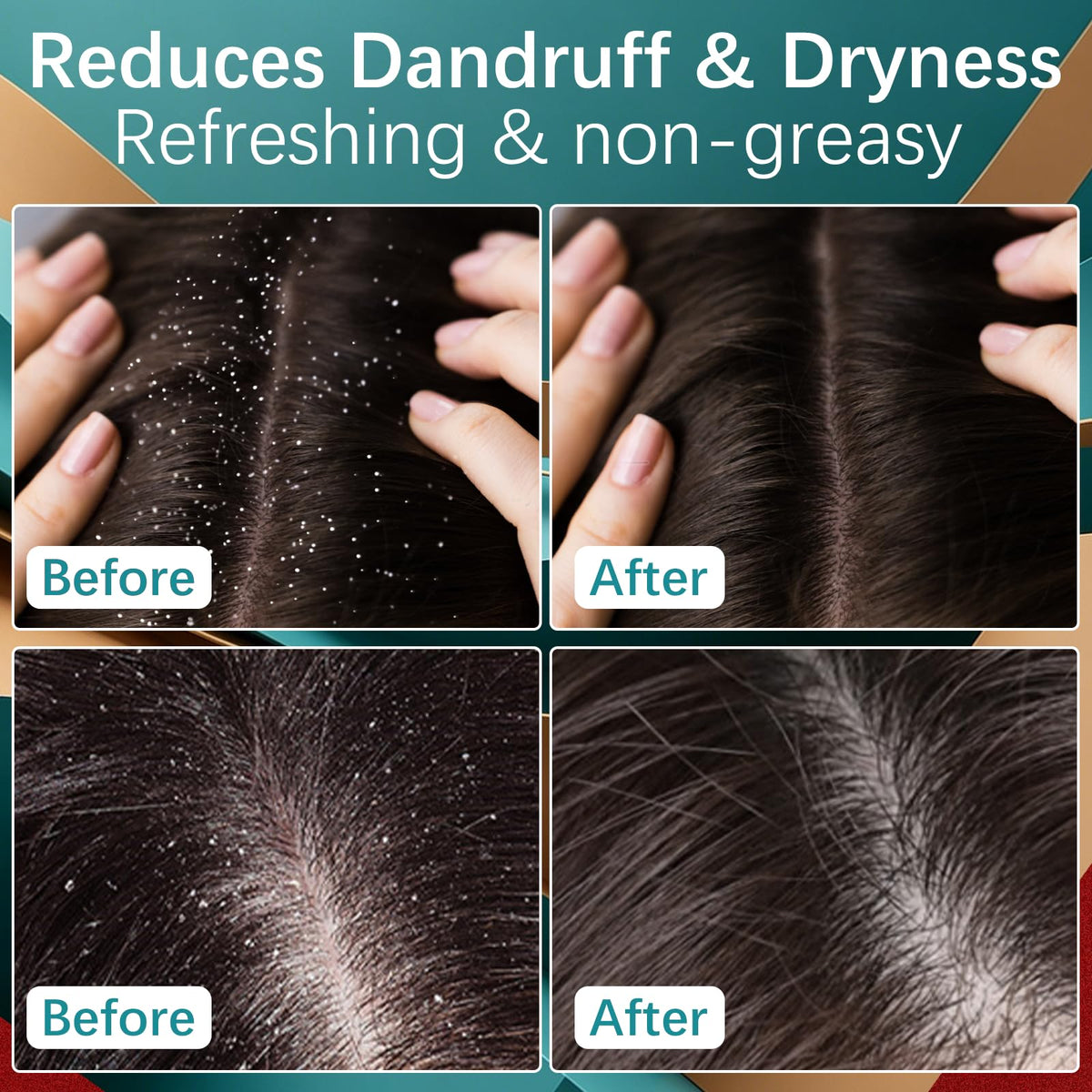 MQN 5% Minoxidil Hair Growth Scalp Massage Cream texture close-up