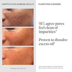 Murad Acne Control Clarifying Cleanser 16.9 Fl Oz with pump