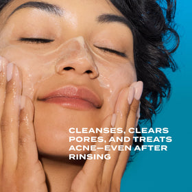 Murad Acne Control Clarifying Cleanser 5 Fl Oz side view