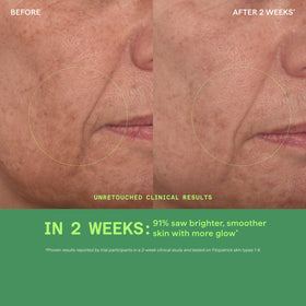 Murad Vita-C Glycolic Brightening Serum with ingredients