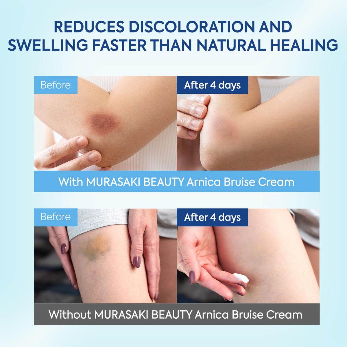 MURASAKI BEAUTY Arnica Bruise Cream on a bathroom shelf