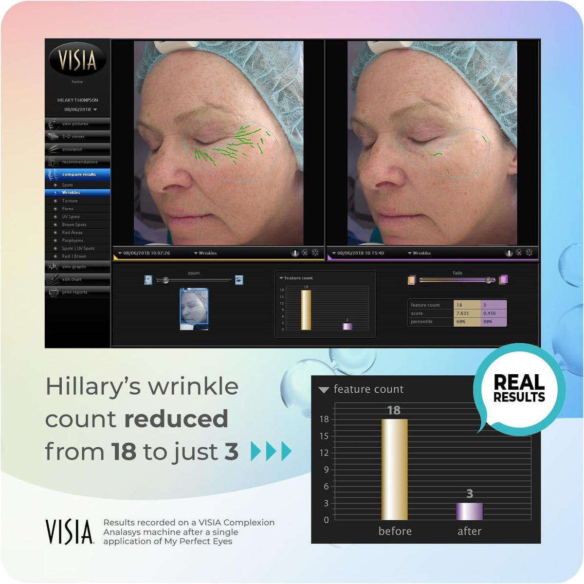 My Perfect Eyes Instant Anti-Wrinkle Eye Cream 10ml packaging details