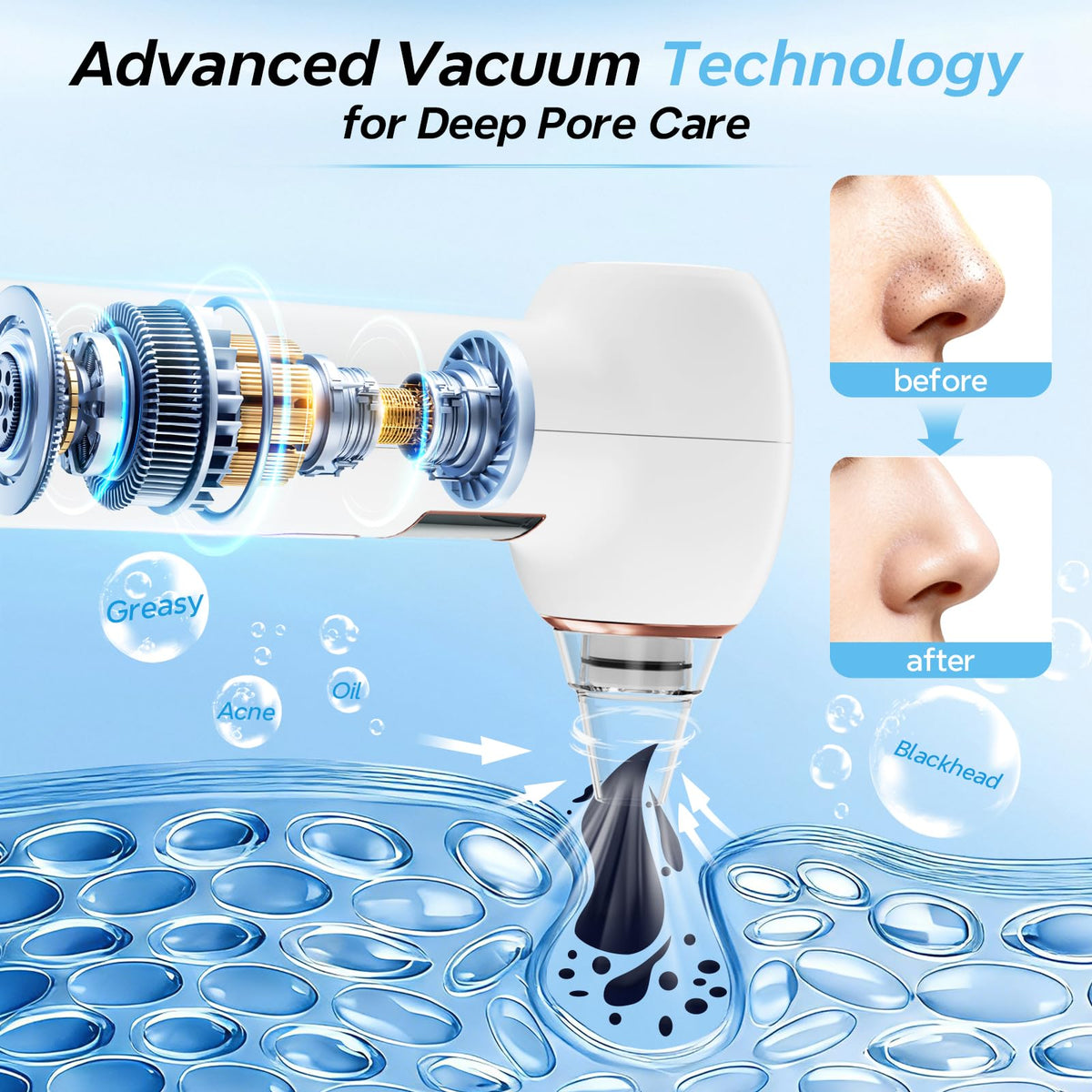 Mylzdobs Blackhead Remover with interchangeable probes