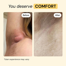 MyMagicHealer Universal Flare Care 1 oz application on skin