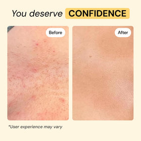 MyMagicHealer Universal Flare Care 1 oz ingredients list