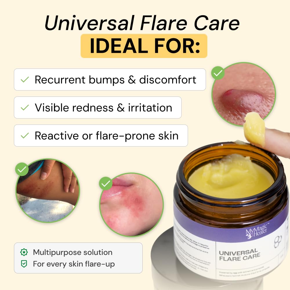 MyMagicHealer Universal Flare Care 1 oz packaging
