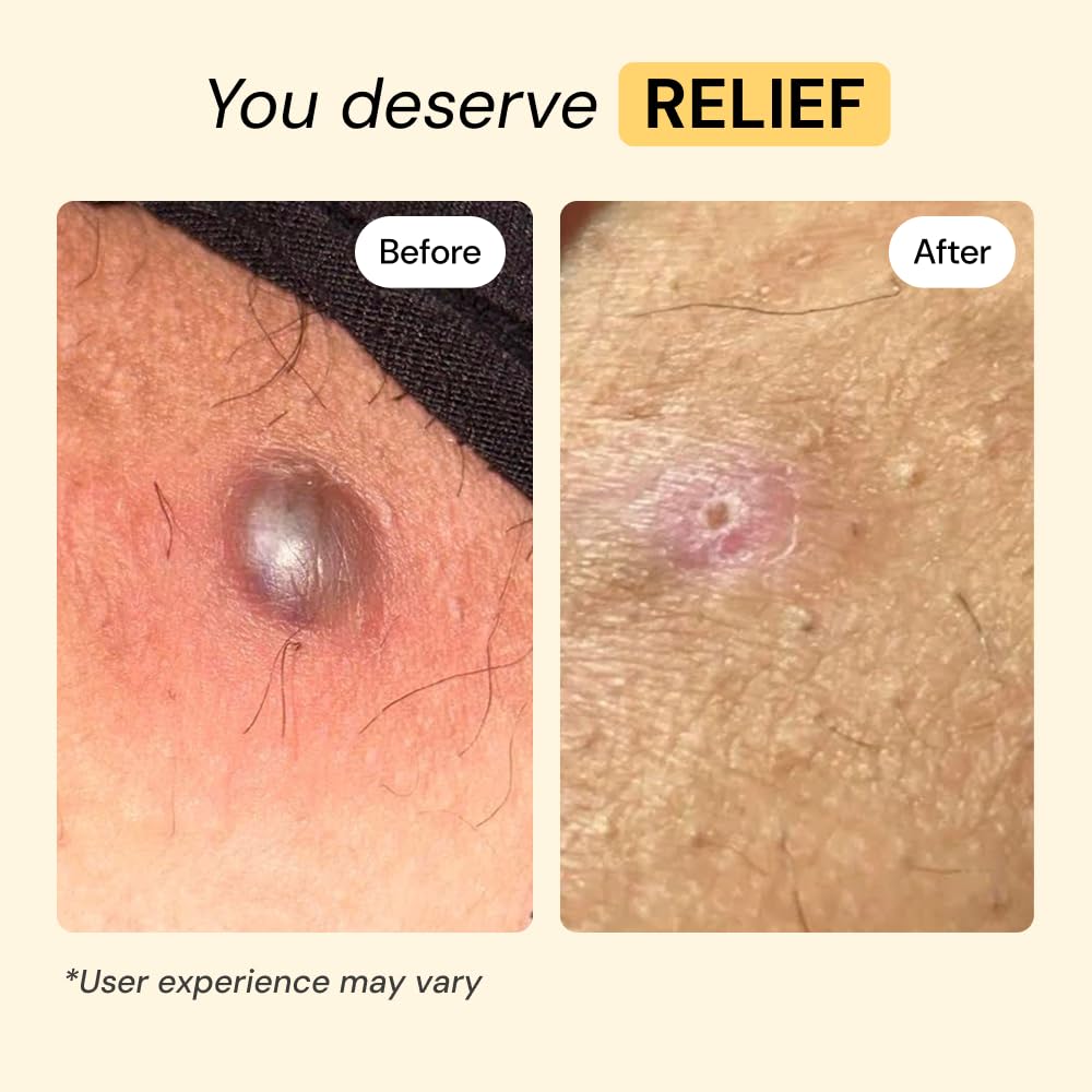 MyMagicHealer Universal Flare Care 1 oz texture close-up