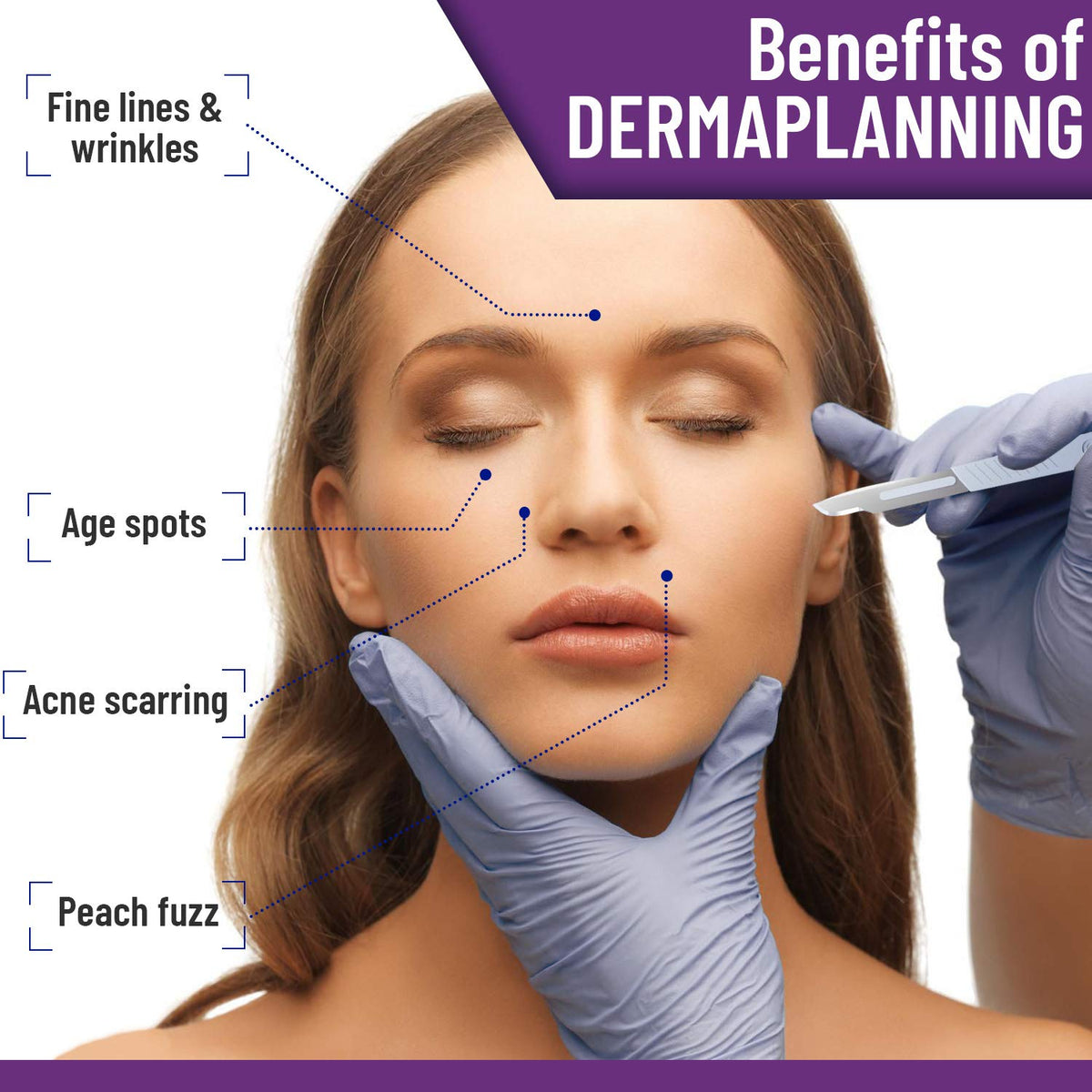 MyMed Disposable Scalpel Blades #15 pack side view