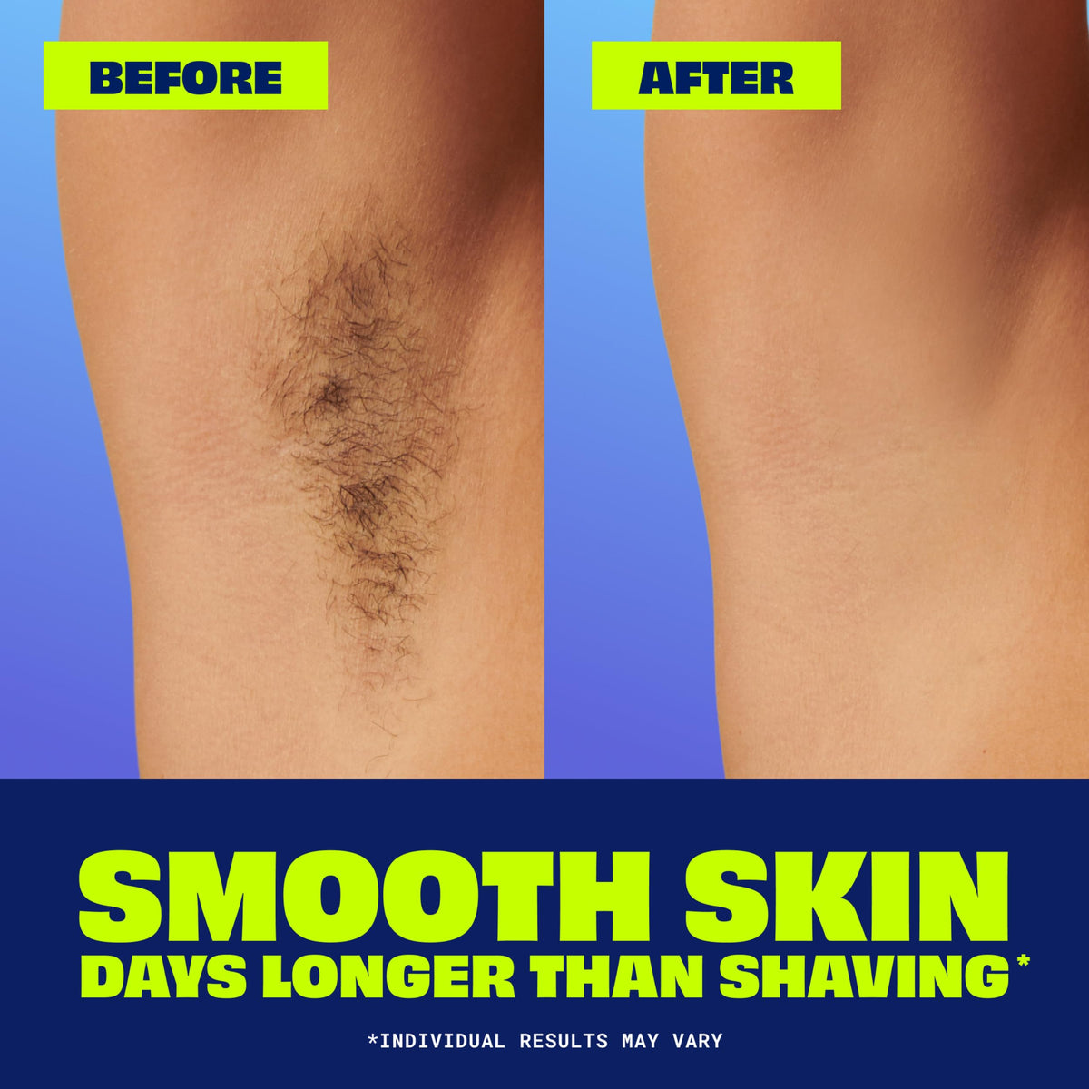 Nair Hair Removal Cream ingredients list