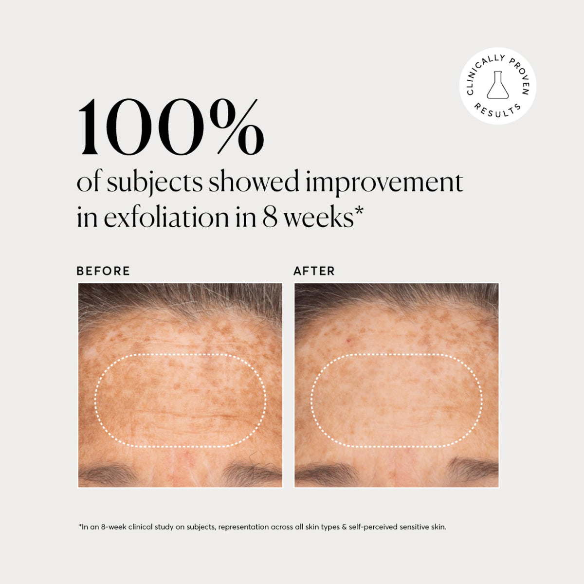 Naturium BHA Liquid Exfoliant 2% in use on skin