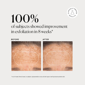 Naturium BHA Liquid Exfoliant 2% in use on skin
