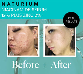 Naturium Niacinamide Face Serum with skincare products