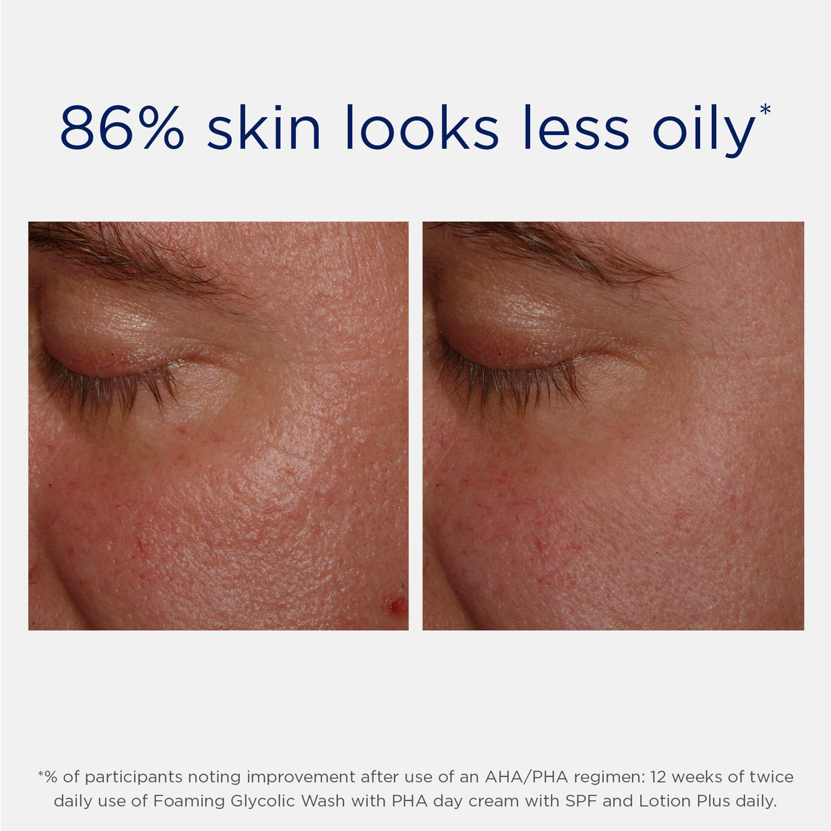 NEOSTRATA Lotion Plus AHA Exfoliating Lotion packaging details