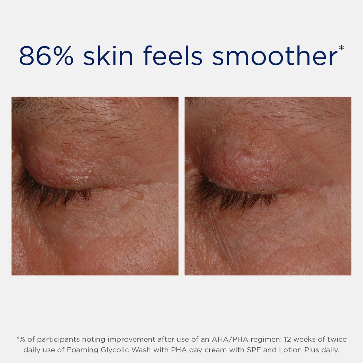 NEOSTRATA Lotion Plus AHA Exfoliating Lotion with other skincare products