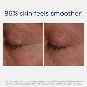 NEOSTRATA Lotion Plus AHA Exfoliating Lotion with other skincare products