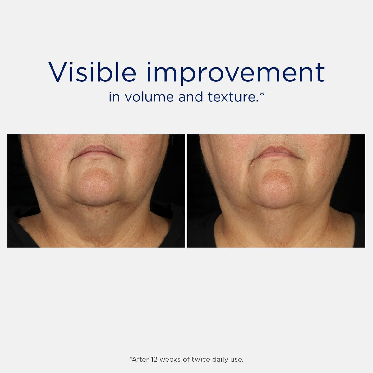 NEOSTRATA Tri-Therapy Lifting Serum close-up of pump.