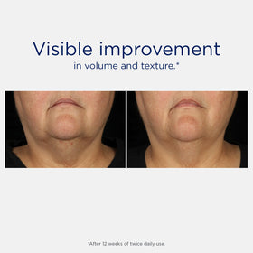 NEOSTRATA Tri-Therapy Lifting Serum close-up of pump.