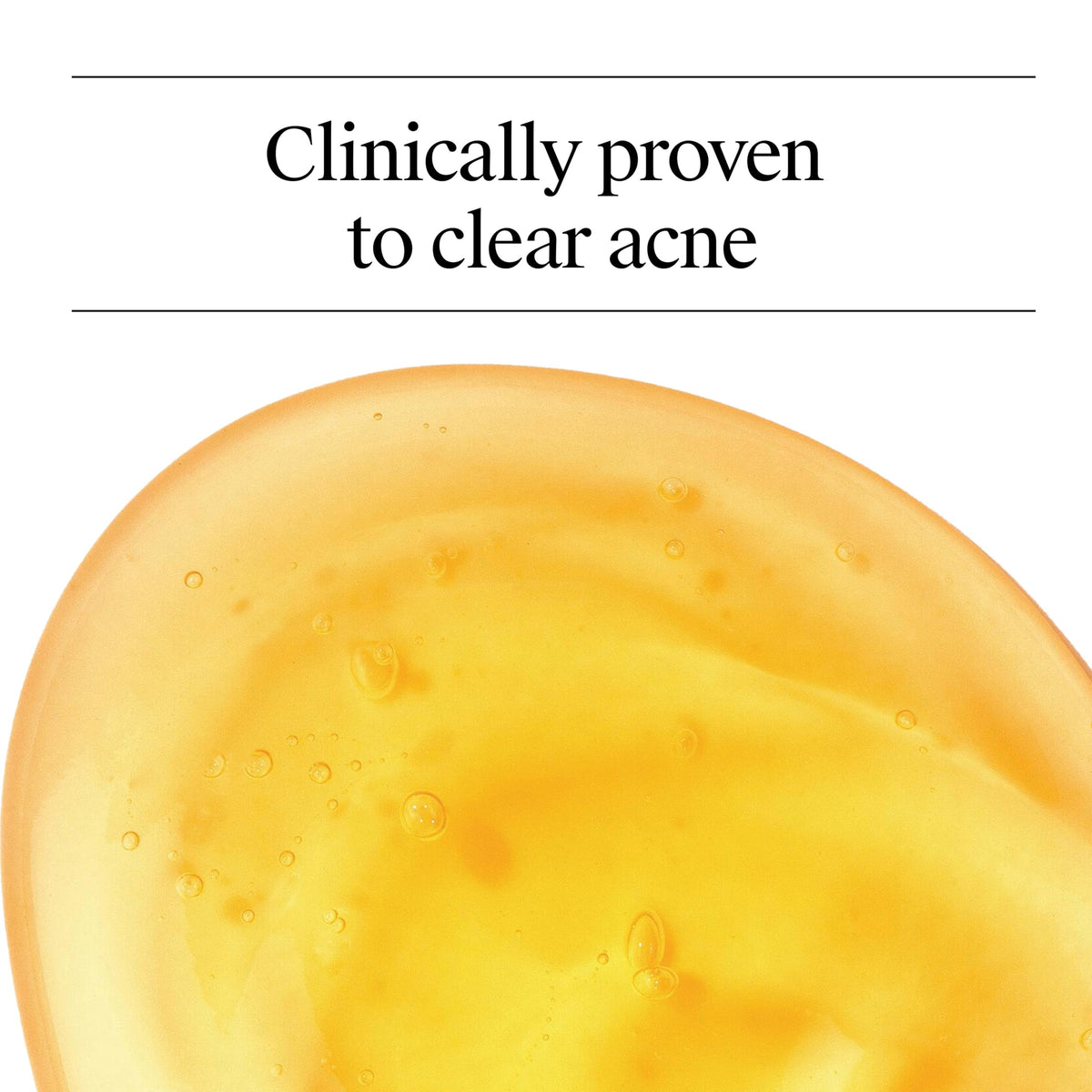 Neutrogena Oil Free Acne Face Wash 9.1 fl. oz side view