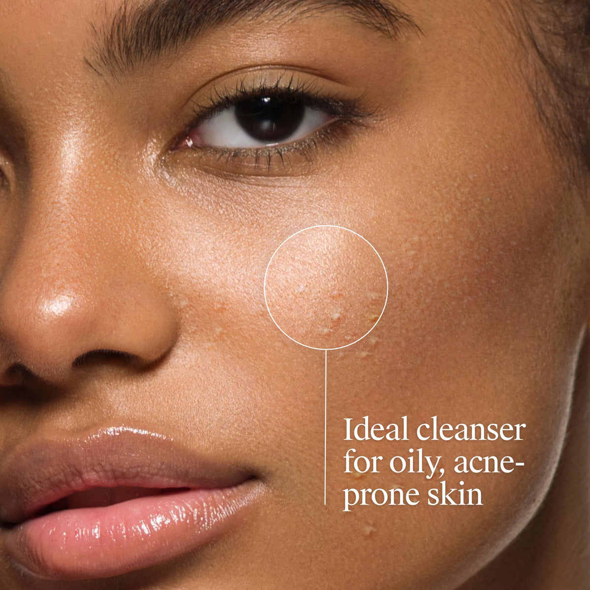 Neutrogena Oil-Free Acne Face Wash 9.1 fl. oz side view