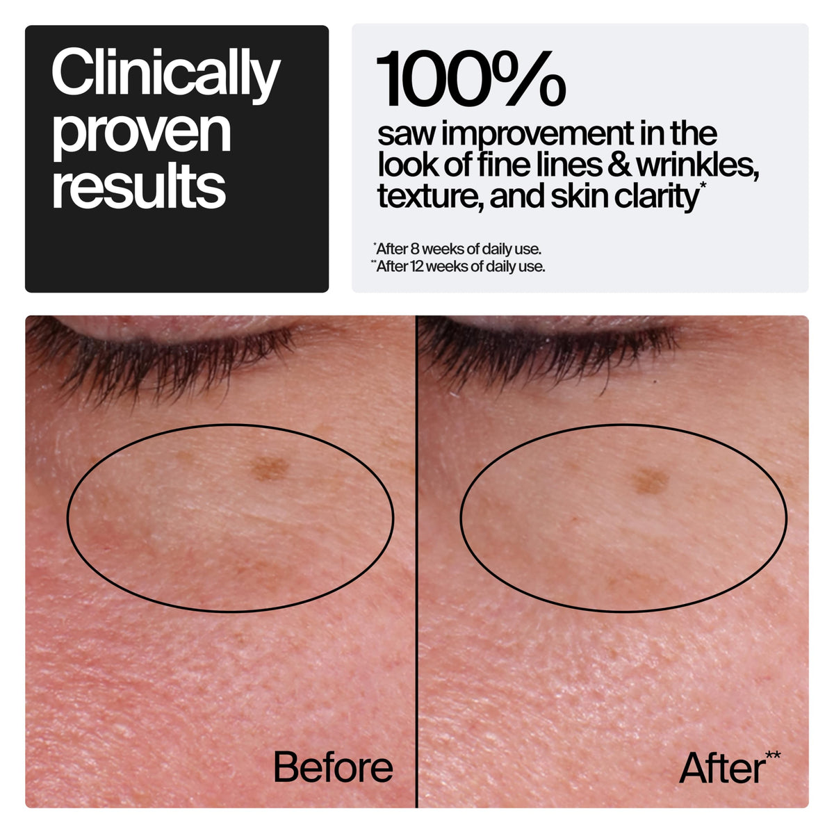 Neutrogena Retinol Regenerating Cream jar with lid off