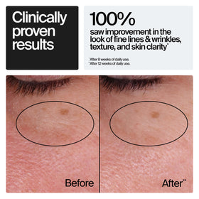 Neutrogena Retinol Regenerating Cream showing texture on hand