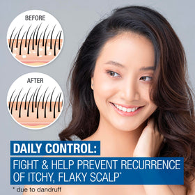 Neutrogena Scalp Therapy Anti-Dandruff Shampoo bottle side view