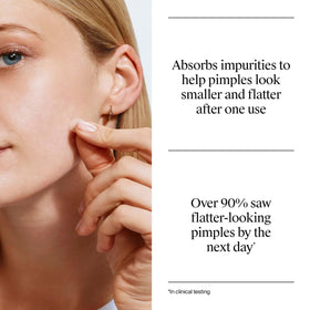 Neutrogena Stubborn Acne Patches on a clean skin surface