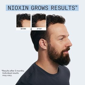 NIOXIN Hair Fall Defense kit with both products displayed