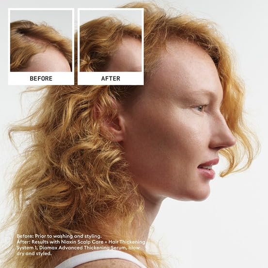 NIOXIN Scalp Therapy Conditioner bottle from the kit
