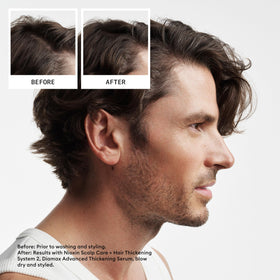 NIOXIN System 2 Scalp Care Shampoo 1110g back view